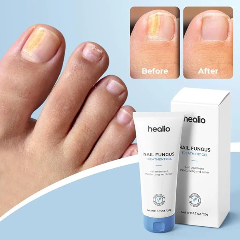 FungaRelief - Advanced Nail Treatment Gel