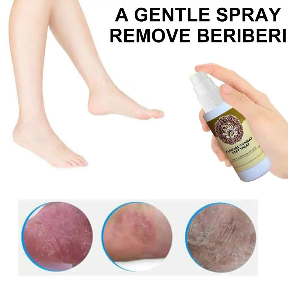FungaRelief - AntiFungal Foot And Shoe Spray