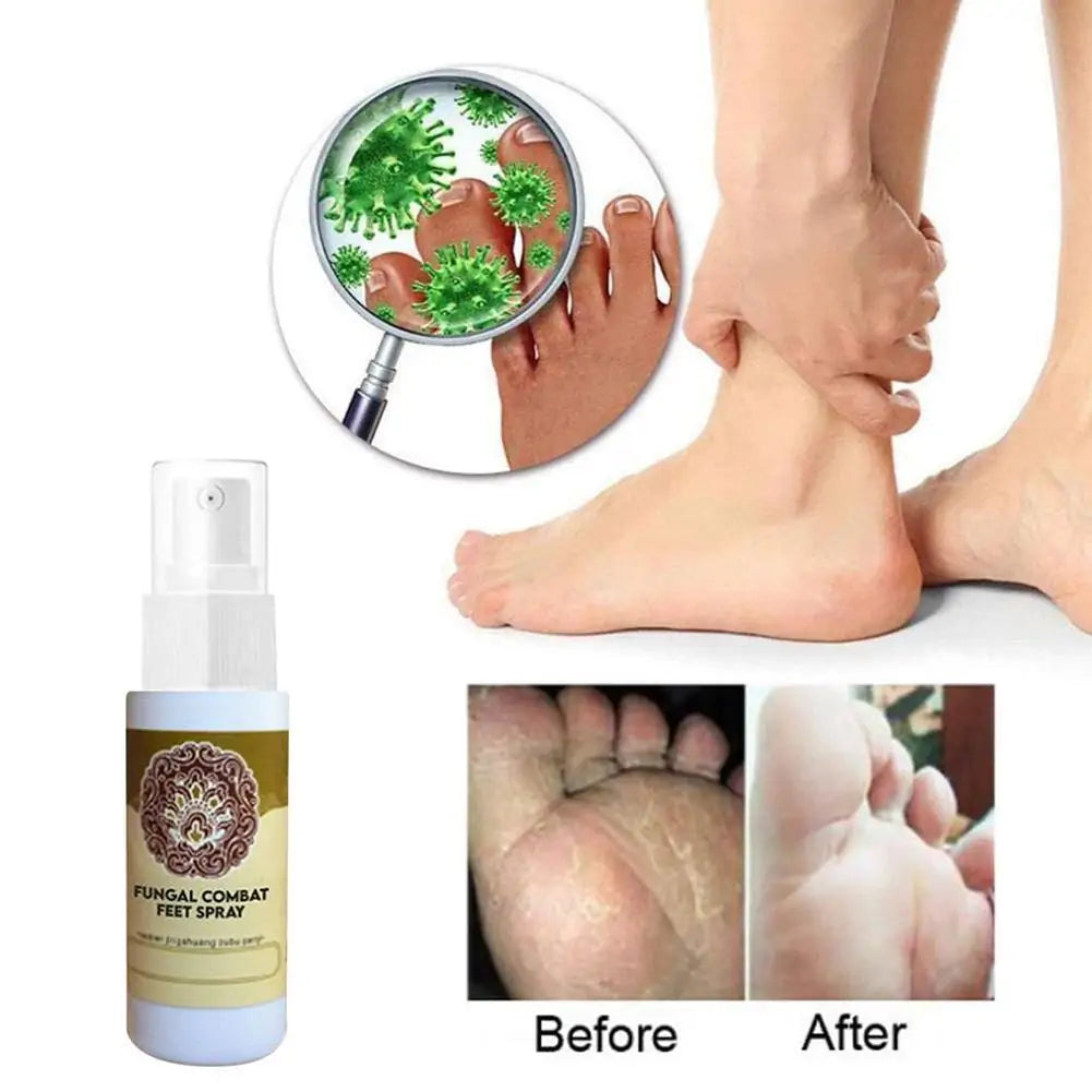 FungaRelief - AntiFungal Foot And Shoe Spray
