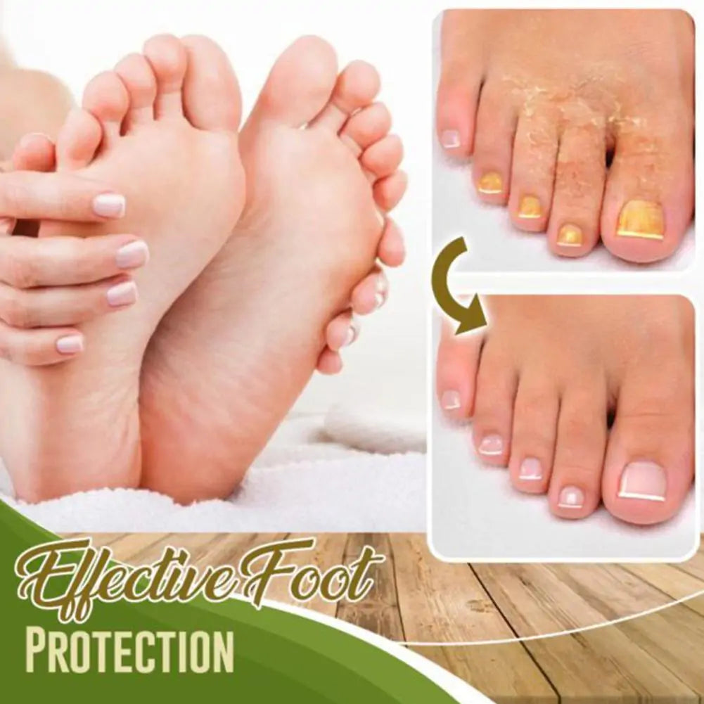 FungaRelief - AntiFungal Foot And Shoe Spray