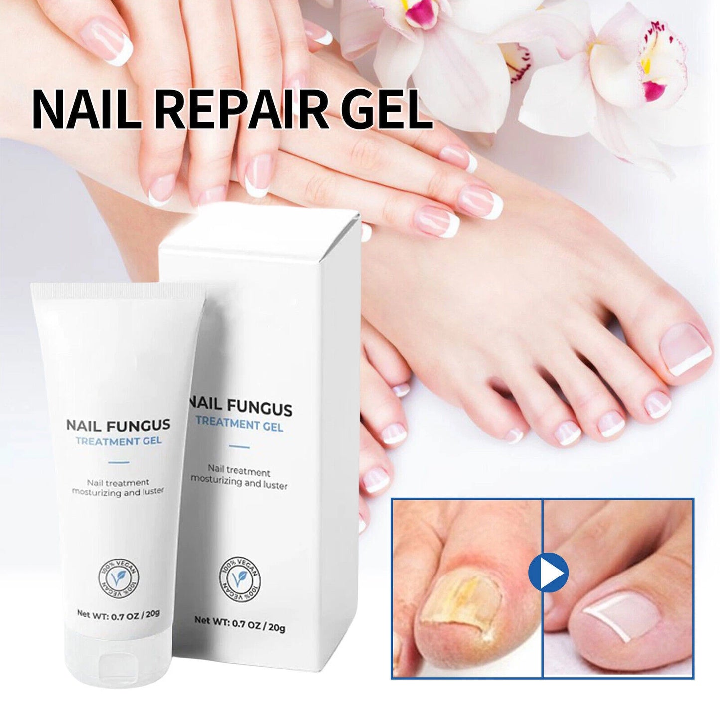 FungaRelief - Advanced Nail Treatment Gel