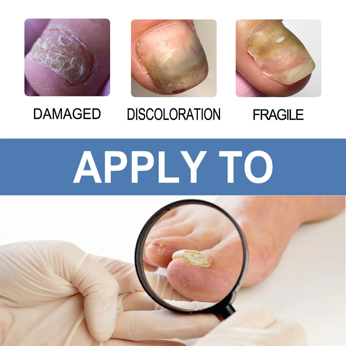 FungaRelief - Advanced Nail Treatment Gel